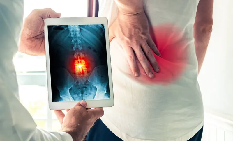  Archivo - Dolor de espalda. - STEPHANE NOIRET/ISTOCK - Archivo 