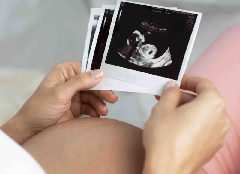  Archivo - Embarazo - CL&Iacute;NICA MARGEN - Archivo 