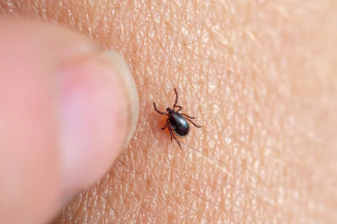  Archivo - Imagen de una garrapata marr&oacute;n en la piel humana con un dedo femenino a punto de retirarla. - FUNDACI&Oacute;N SOS LYME - Archivo 