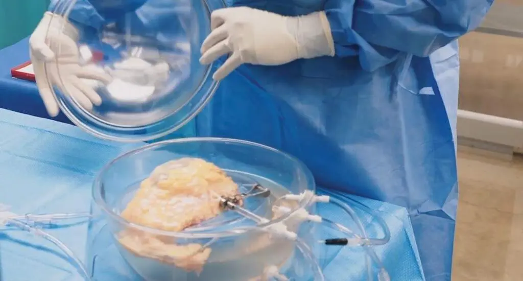  El equipo de 34 vidas con un ri&ntilde;&oacute;n 