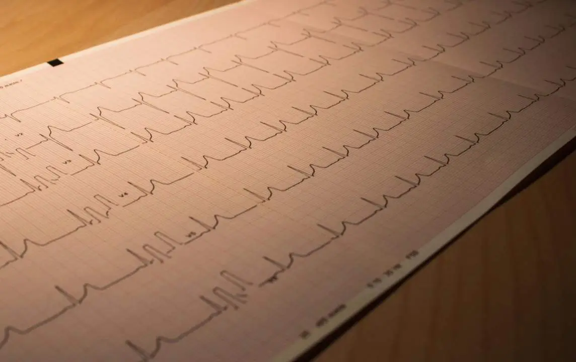  Imagen que ilustra el estudio 'Cardiobar&oacute;metro espa&ntilde;ol' - IBS.GRANADA 