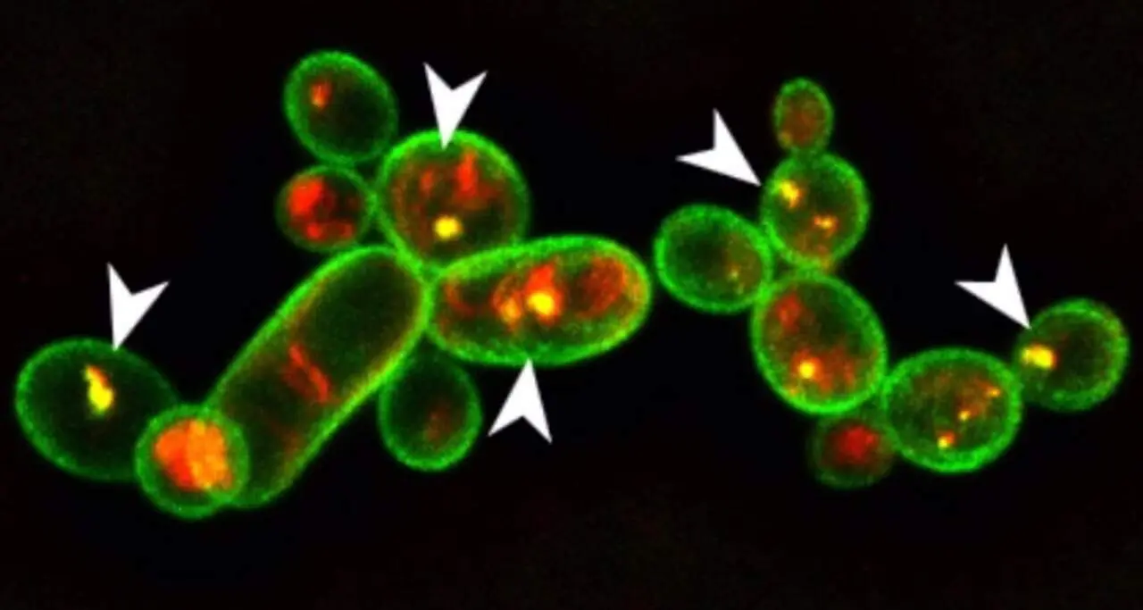  Vista microsc&oacute;pica de cultivo tratado con con Cyclo(Pro-Tyr)./IHSM 'La Mayora' - CSIC 