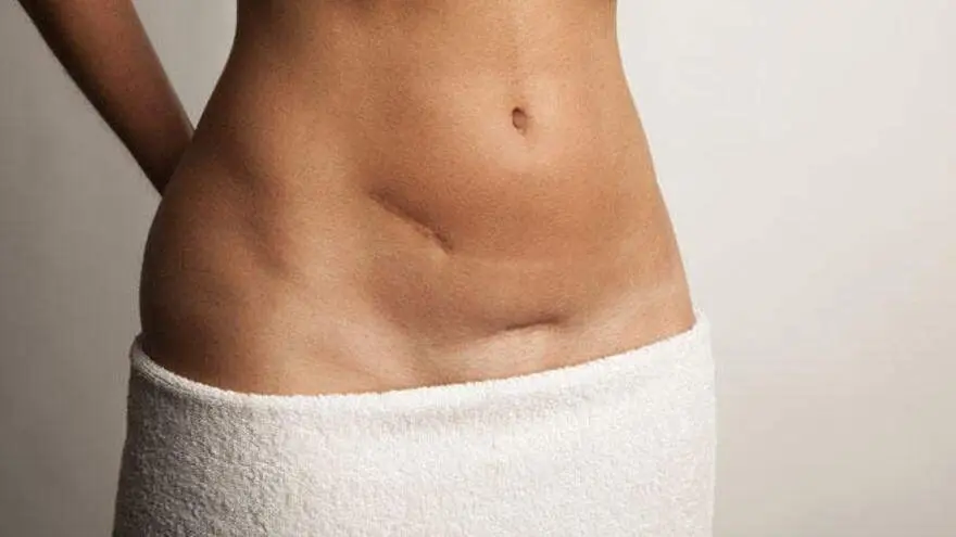  Paciente extirpada de sus ovarios 