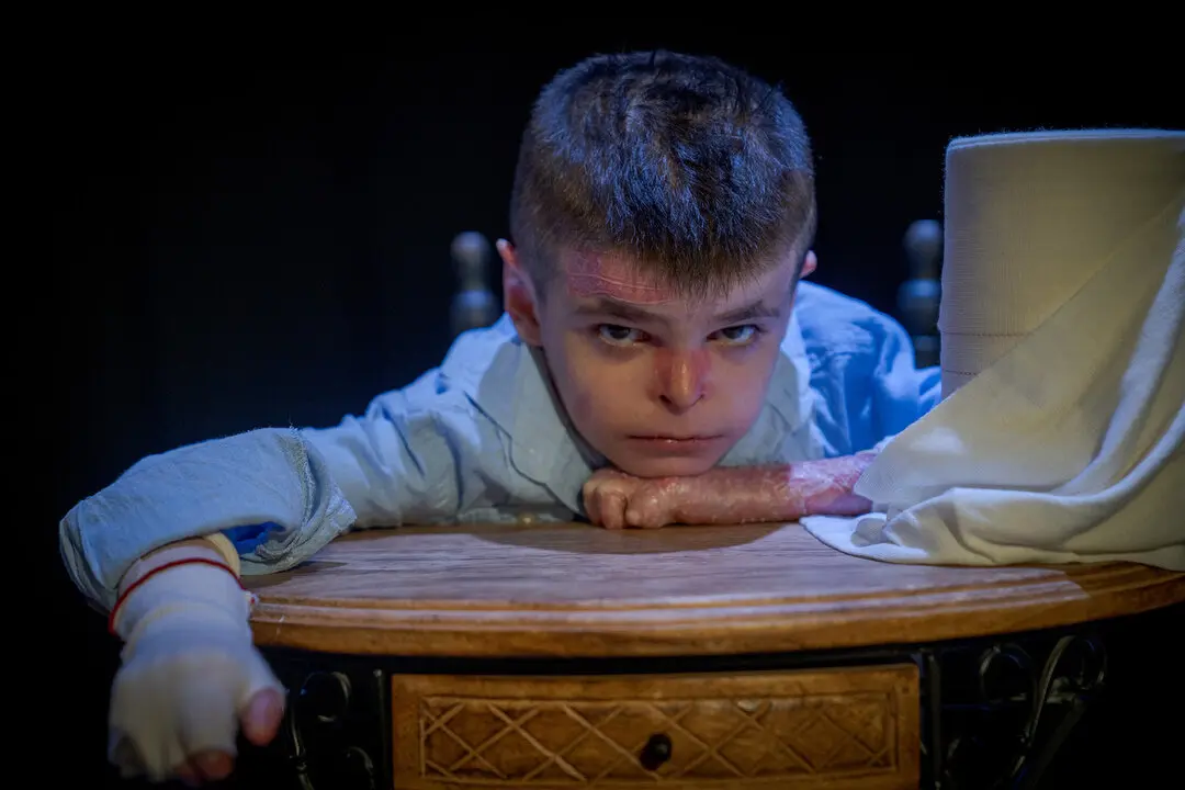  Leo, el peque&ntilde;o de 11 a&ntilde;os con Piel de Mariposa 