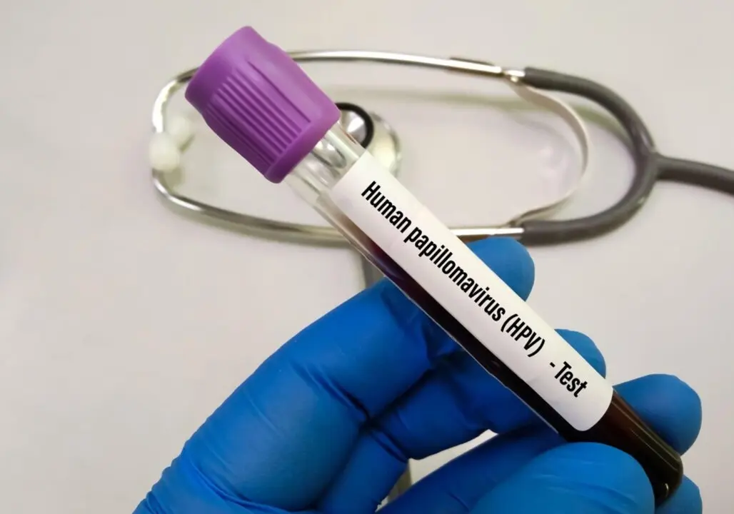  Archivo - Imagen de archivo de una prueba del virus del papiloma humano. - DOCOR - Archivo 