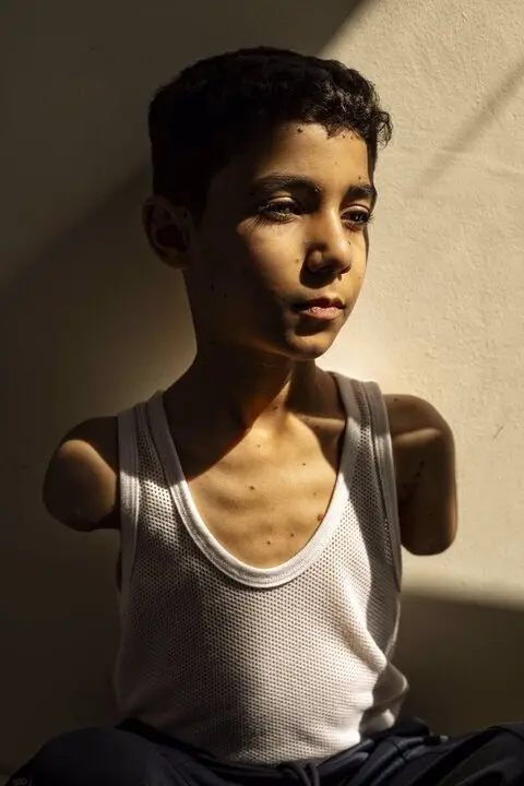  Mahmoud, un ni&ntilde;o de Gaza mutilado, foto del a&ntilde;o del World Press Photo. - WORLD PRESS PHOTO 