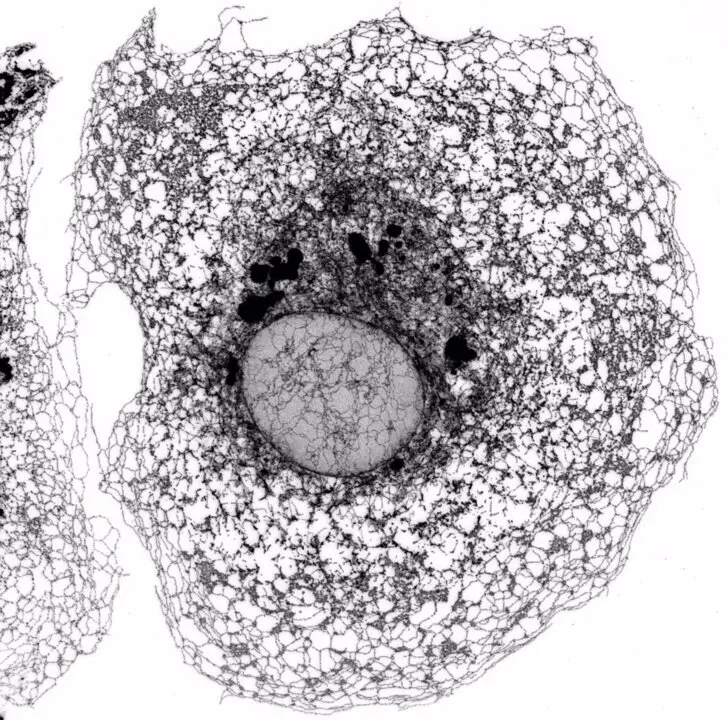  Microscop&iacute;a confocal de alta resoluci&oacute;n del ret&iacute;culo endopl&aacute;smico de una c&eacute;lula de ri&ntilde;&oacute;n de mono verde. - MIGUEL S&Aacute;NCHEZ (IIBM-CSIC-UAM) 