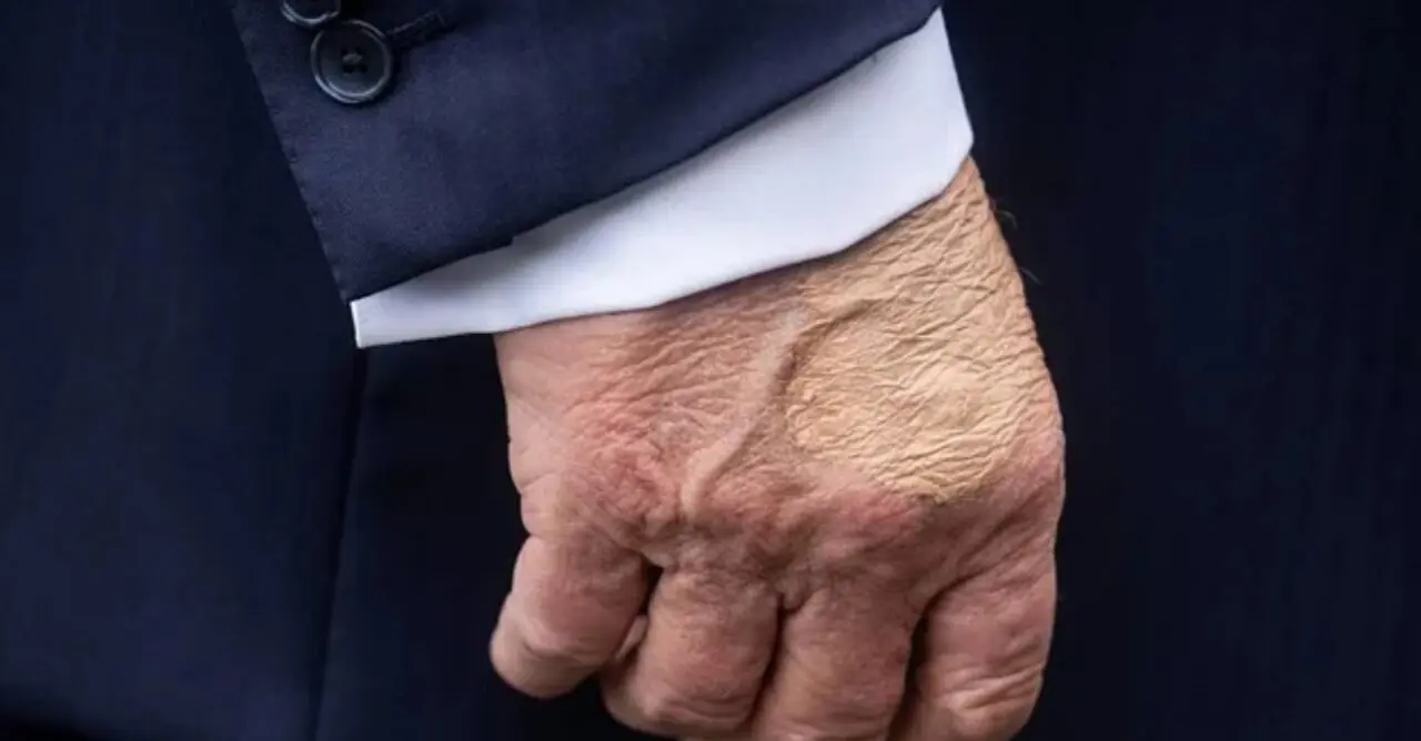  La mano maquillada de Trump 