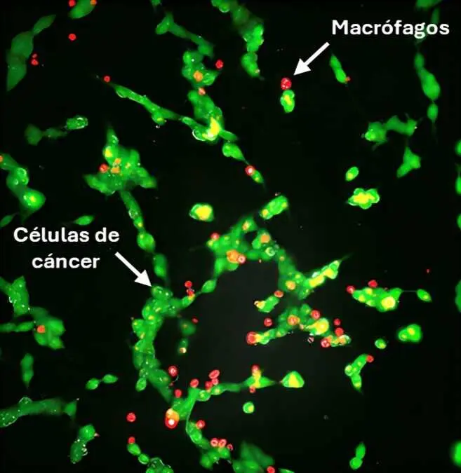 Microscop&iacute;a electr&oacute;nica de c&eacute;lulas de c&aacute;ncer de neuroblastoma tratadas inicialmente con liposomas y posteriormente macr&oacute;fagos modificados con liposomas.