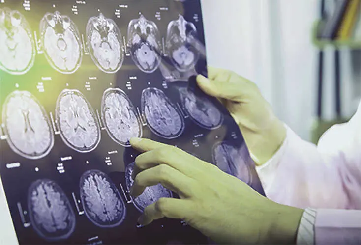 Investigaci&oacute;n Alzheimer | Grifols