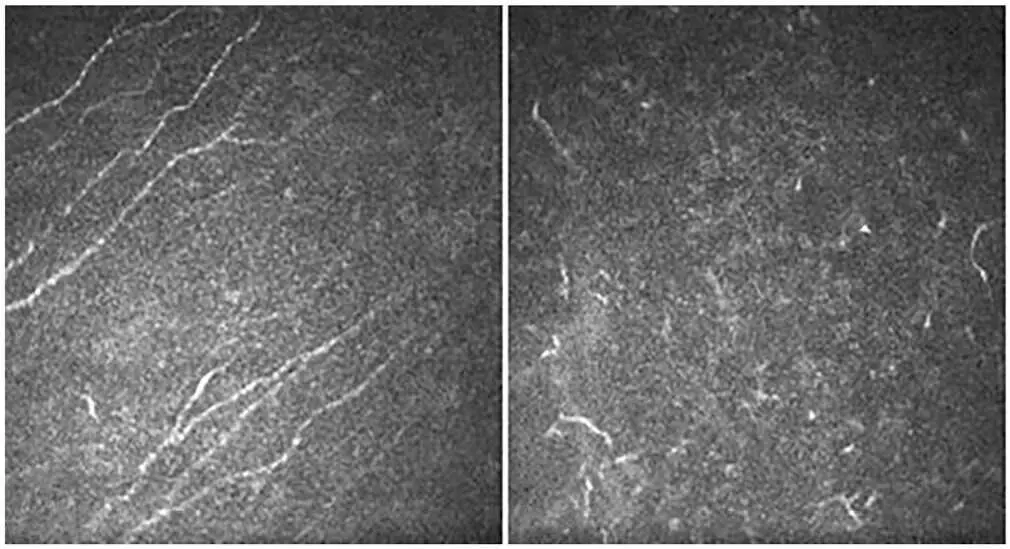 Current Eye Research, 2024. doi: 10.1080/02713683.2024.2320779