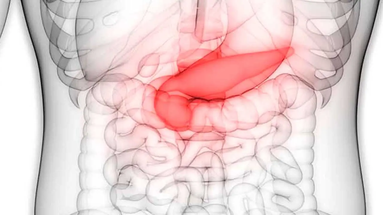 Estudios m&eacute;dicos logran avances en el diagn&oacute;stico y tratamiento del c&aacute;ncer pancre&aacute;tico.