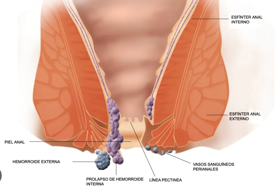 Herromoides. WIKIPEDIA