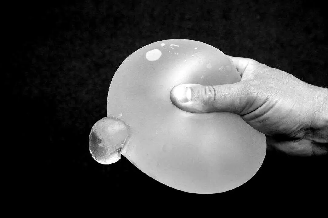 Una de cada diez pr&oacute;tesis mamarias se rompe en los primeros diez a&ntilde;os