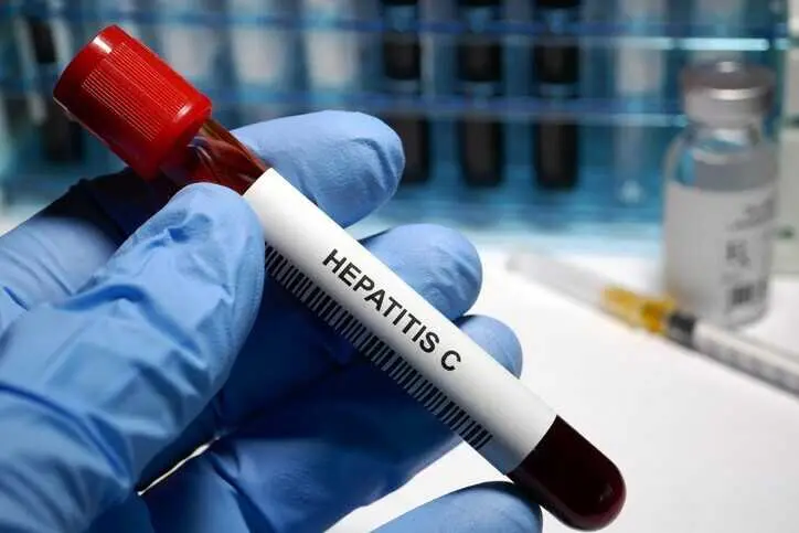 Archivo - Europa no cumple ODS que busca el fin de VIH y tuberculosis y combatir hepatitis viral e ITS, con 59.000 muertes al a&ntilde;o