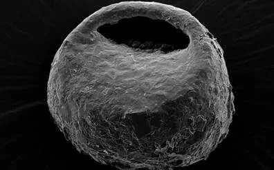 Imagen de microscop&iacute;a electr&oacute;nica de la especie terrestre Centropyxis orbicularis.