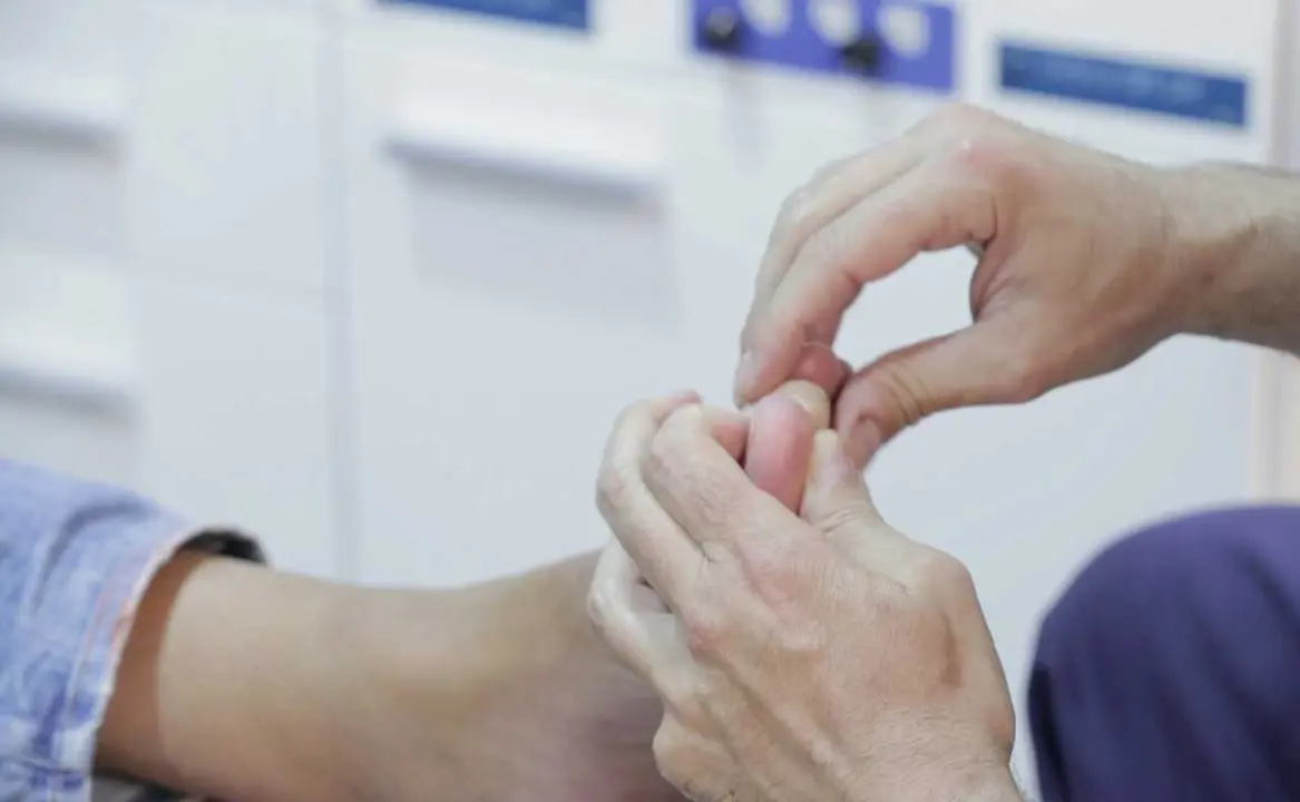 Archivo - Pod&oacute;logos advierten de las diez lesiones de los pies que se disparan en primavera: del dolor de tal&oacute;n a u&ntilde;as encarnadas