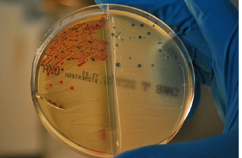 <p> Archivo - Bacterias resistentes a los antibióticos aisladas en el IRYCIS. / - JERÓNIMO RODRÍGUEZ BELTRÁN - Archivo </p>