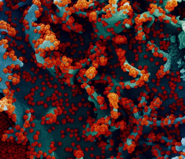 <p> Micrografía electrónica de barrido coloreada de una célula infectada con SARS-CoV-2. - NIAID </p>
