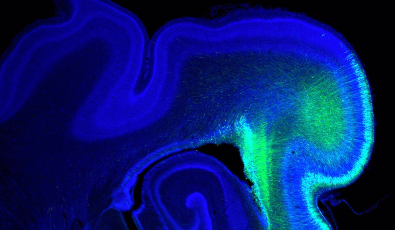 <p> Imagen del cerebro de un hurón. - IN (CSIC-UMH) </p>
