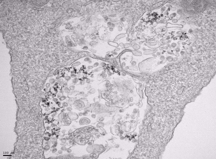 <p> Imagen de microscopía de transmisión electrónica de células infectadas con SARS-CoV-2 y tratadas con nanopartículas de óxido de hierro. - CNB-CSIC </p>
