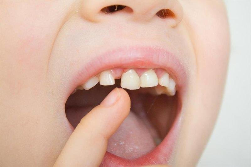  Dientes de leche, dientes de niño, boca de niño - CEDIDA - COMPROMISO Y SEGURIDAD DENTAL 