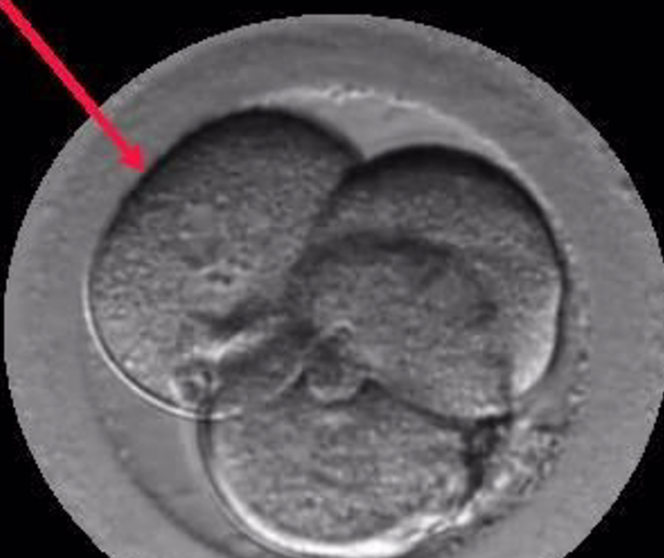 <p> Embrión Multinucleado. - Institut Marquès </p>