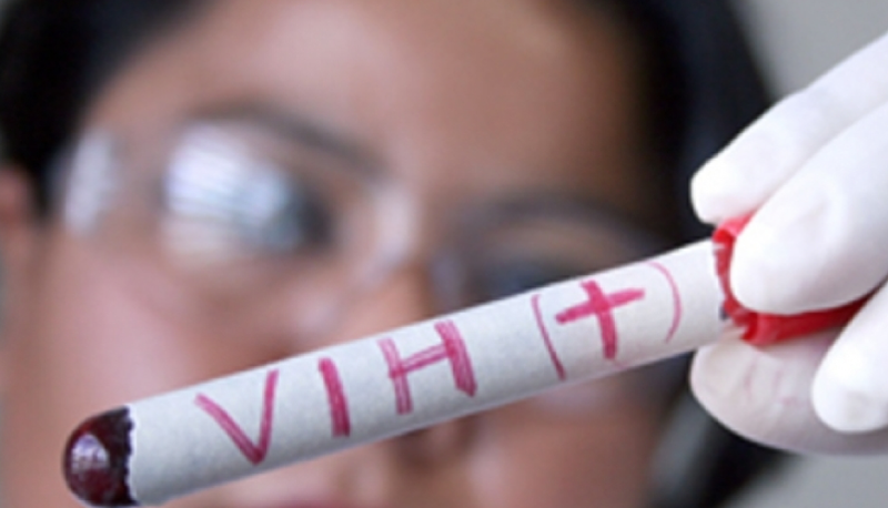 <p> Muestra de VIH en un laboratorio | Agencias </p>