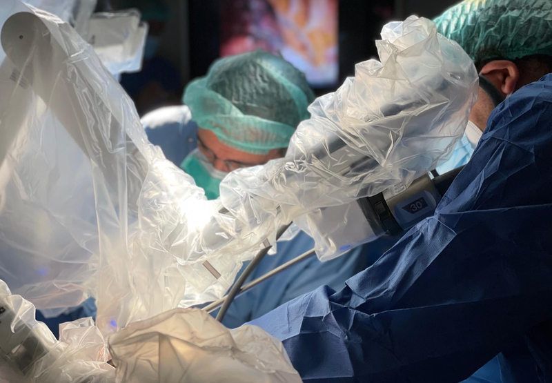 <p> El Hospital de Bellvitge extrae la primera costilla con cirugía robótica y una incisión - HOSPITAL DE BELLVITGE </p>
