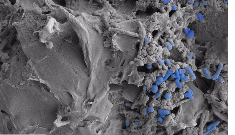 <p> Imagen microscópica de microplásticos colonizados por la microbiota intestinal. - CSIC </p>