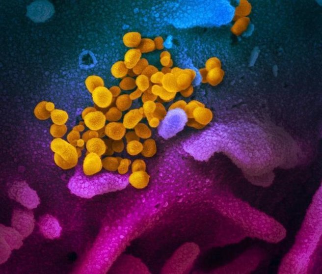 <p> Archivo - Imagen de microscopio electrónico de barrido muestra SARS-CoV-2 (amarillo), también conocido como 2019-nCoV, el virus que causa COVID-19, aislado de un paciente en los EE. UU. ) cultivados en el laboratorio. - NIAID RML - Archivo </p>