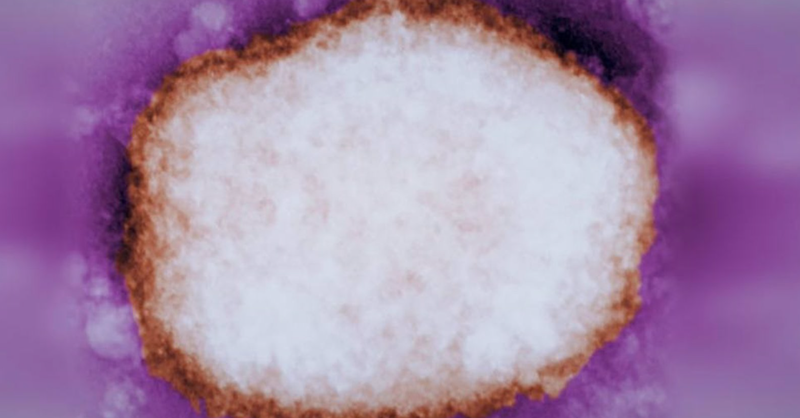 <p> Partícula amplificada del virus de la viruela del mono. - CDC </p>