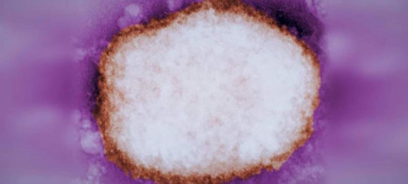 <p> Partícula amplificada del virus de la viruela del mono </p>