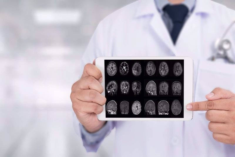 <p> Radiografía del cerebro humano </p>