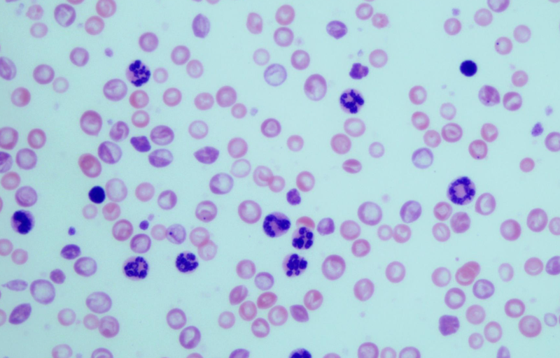 <p> Granulocitos en muestras sanguíneas de ratones con leucemia mielogénica crónica. - CSIC </p>