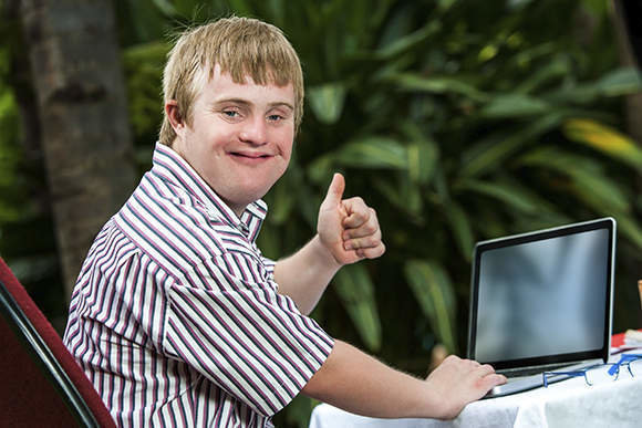Portrait of handicapped student doing thumbs up sign next to laptop outdoors.