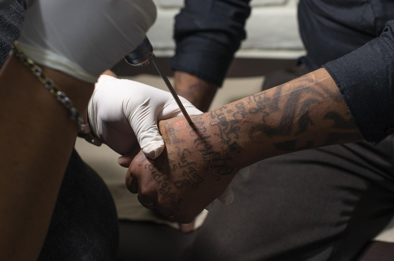  Archivo - Borrado de tatuajes de un miembro de una mara, Barrio 18, en El Salvador - GILES CAMPBELL / ZUMA PRESS / CONTACTOPHOTO 