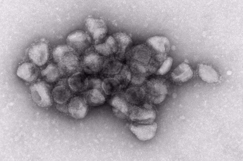  Imagen de microscopía electrónica de un agregado de partículas virales pseudotipadas con la proteína de espiga de la variante Delta del SARS-CoV-2 
