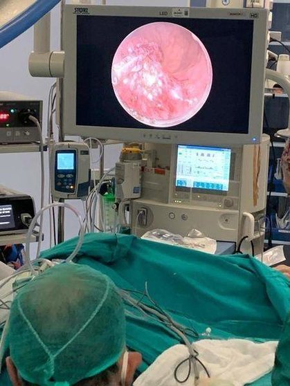  Un momento de la intervención de un tumor rectal mediante cirugía endoscópica transanal 