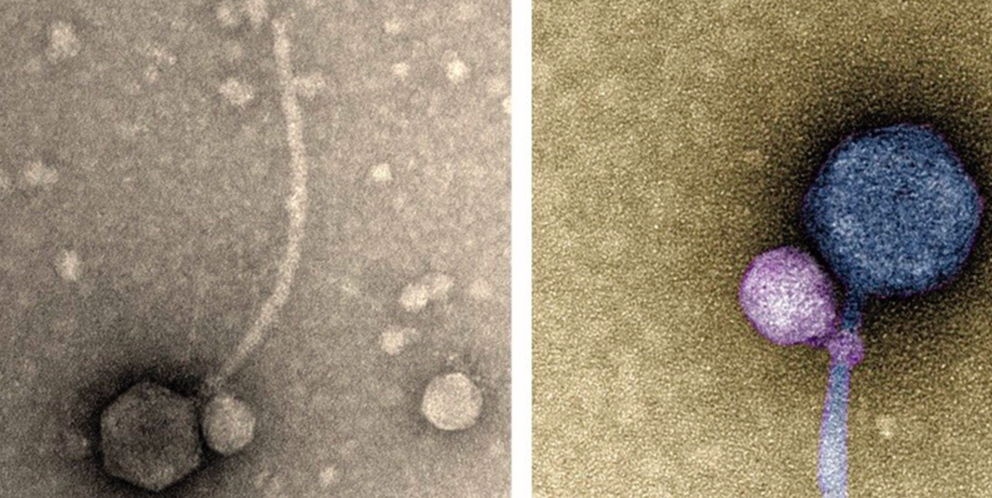  Imágene obtenidas con microscopía TEM y coloreadas del virus satélite adherido a su ayudante - TAGIDE DECARVALHO - UMBC - UAB 