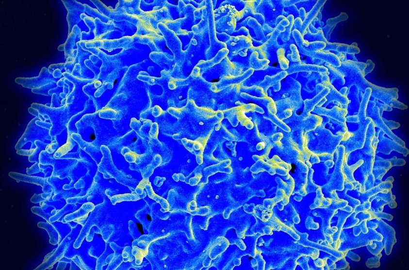  Archivo - Imagen de micrografía de un linfocito T humano del sistema inmunitario. - NIAID - Archivo 