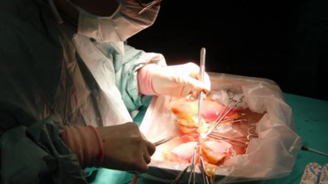  Extracci&oacute;n &oacute;rganos. Donaci&oacute;n.organos.ua.es 