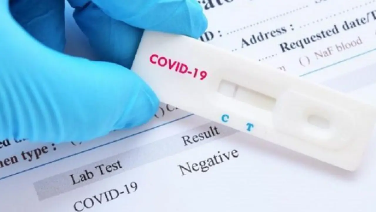  Test coronavirus. 