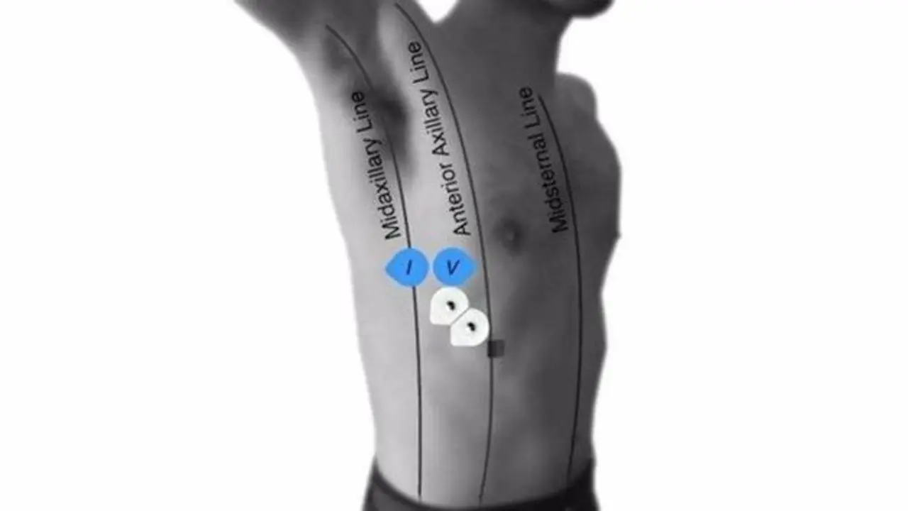  fotonoticia_20210416122819_1920 