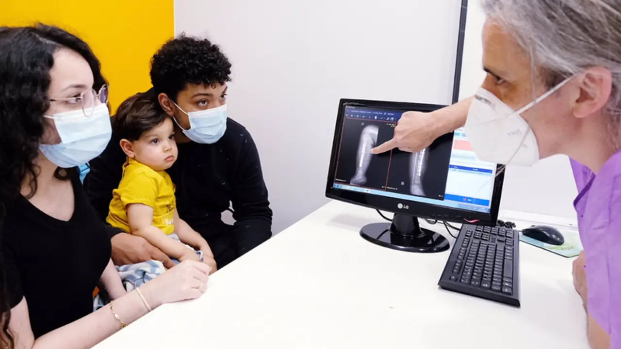  Un beb&eacute; de 23 meses salva su pierna derecha afectada por una malformaci&oacute;n de la tibia con un autotrasplante - HM HOSPITALES 