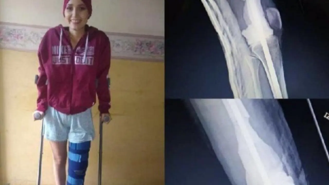  La joven madrile&ntilde;a pide ayuda lanzando un crowfunding - YOSMELY LEAL ZAMBRANO
Obtenido de EuropaPress 