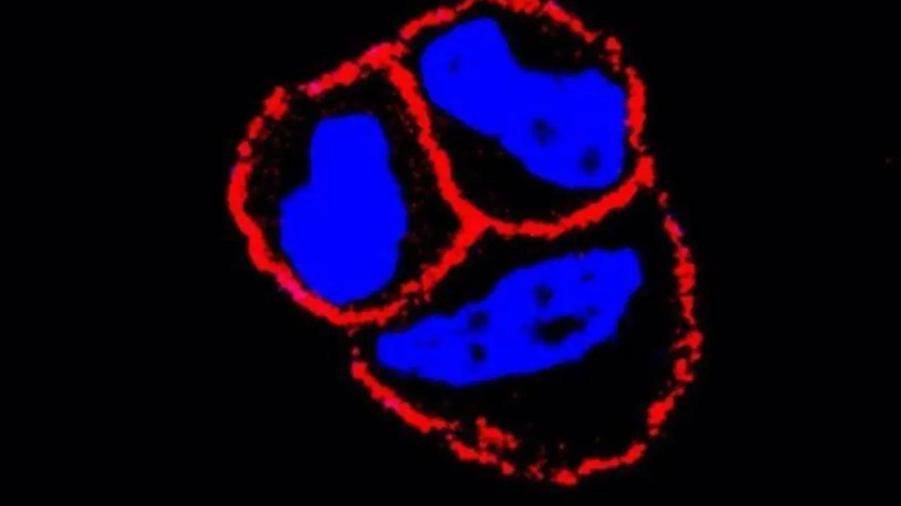  El CSIC evidencia que el uso combinado de un nuevo f&aacute;rmaco mejora la eficiencia de algunas terapias de c&aacute;ncer de mama. // EP 