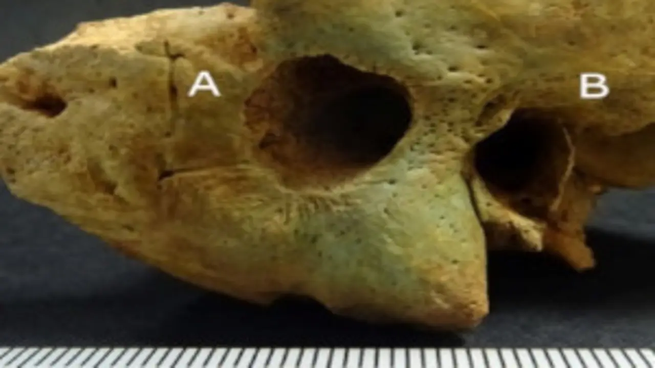  Perforaci&oacute;n de unos 12 mm de di&aacute;metro detr&aacute;s del orificio del o&iacute;do derecho. Universidad Aut&oacute;noma de Barcelona. 