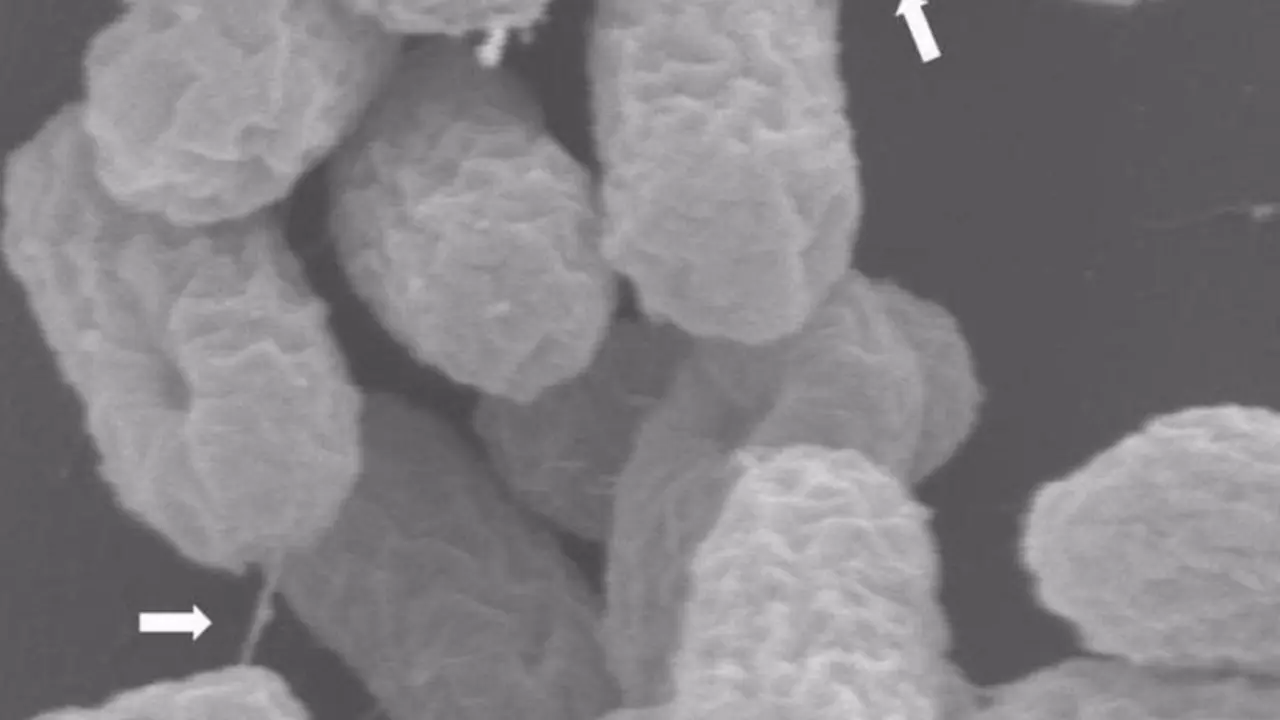  Superbacterias atrapadas en el acto de transferir un pl&aacute;smido de resistencia a antibi&oacute;ticos a trav&eacute;s de su pilus similar a una jeringa, marcado con flechas. 