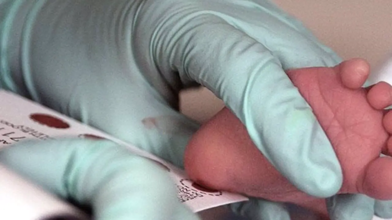  Archivo - Pie de reci&eacute;n nacido - US GOVERNMENT - Archivo 